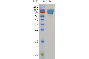 Mouse B7-H2 Protein, hFc Tag on SDS-PAGE under reducing condition.