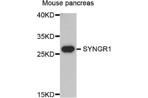 Western blot analysis of extracts of mouse pancreas, using SYNGR1 antibody. (Synaptogyrin 1 anticorps)