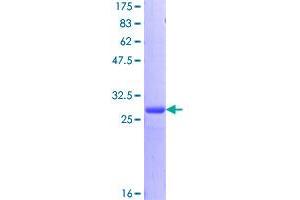 Image no. 1 for Breast Cancer 1 (BRCA1) (AA 1-59) protein (GST tag) (ABIN1346845)