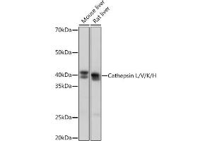 Western blot analysis of extracts of various cell lines, using Cathepsin L/V/K/H Rabbit mAb (ABIN7266150) at 1:1000 dilution. (Cathepsin L anticorps)