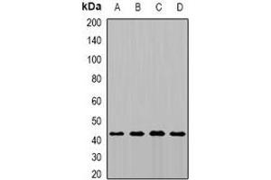 Western blot analysis of MTCH1 expression in MCF7 (A), HepG2 (B), mouse kidney (C), rat brain (D) whole cell lysates.