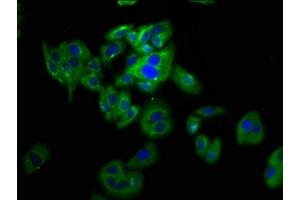 Immunofluorescence staining of HepG2 cells with ABIN7162587 at 1:133, counter-stained with DAPI. (Pannexin 2 anticorps  (AA 370-470))