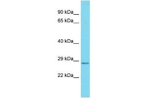 Host:  Rabbit  Target Name:  Nr2c1  Sample Type:  Mouse Stomach lysates  Antibody Dilution:  1. (NR2C1 anticorps  (Middle Region))