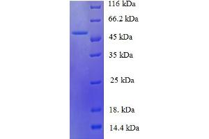 MDH (AA 2-312) protein (His tag)