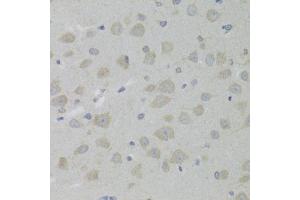 Immunohistochemistry of paraffin-embedded rat brain using HSD17B13 Antibody.