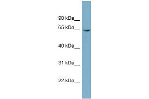 WB Suggested Anti-PGM3 Antibody Titration: 0. (Phosphoglucomutase 3 anticorps  (N-Term))