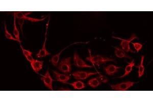 ABIN6277247 staining Hela by IF/ICC. (DKK3 anticorps)