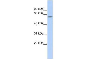 WB Suggested Anti-ZNF205 Antibody Titration:  0. (ZNF205 anticorps  (Middle Region))
