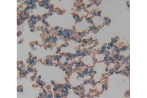 Used in DAB staining on fromalin fixed paraffin- embedded Kidney tissue