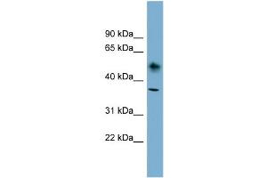 WB Suggested Anti-ATP1B1 Antibody Titration:  0. (ATP1B1 anticorps  (N-Term))