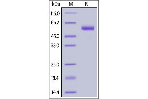 Human CD7, Llama IgG2b Fc Tag, low endotoxin on  under reducing (R) condition.
