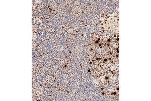 Immunohistochemical analysis of paraffin-embedded Human tonsil tissue using A performed on the Leica® BOND RXm. (HIST1H3B3 (pSer10) anticorps)