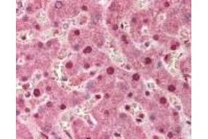 Immunohistochemistry (IHC) image for anti-Protein Phosphatase 1, Regulatory Subunit 13 Like (PPP1R13L) (AA 780-797) antibody (ABIN2470264)