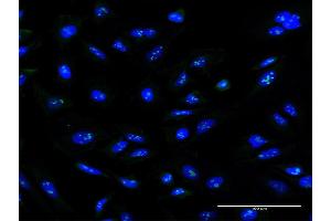 Immunofluorescence of monoclonal antibody to ZNF100 on HeLa cell. (ZNF100 anticorps  (AA 99-206))