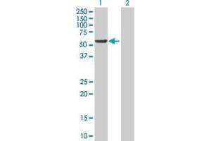 Western Blot analysis of RGS6 expression in transfected 293T cell line by RGS6 MaxPab polyclonal antibody. (RGS6 anticorps  (AA 1-472))