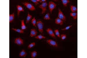 IF analysis of Elovl4 using anti-Elovl4 antibody (ABIN7599257). (ELOVL4 anticorps  (AA 1-312))