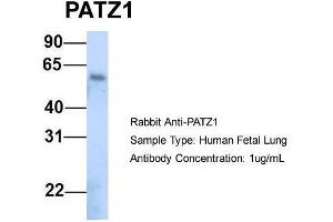 Host:  Rabbit  Target Name:  PATZ1  Sample Type:  Human Fetal Lung  Antibody Dilution:  1. (PATZ1 anticorps  (N-Term))