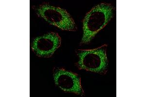 Fluorescent ige of  cell stained with P2K2 Antibody  (ABIN6243254 and ABIN6579024)/SA080220AJ. (MEK2 anticorps  (AA 372-400))