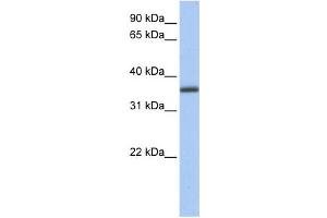 Western Blotting (WB) image for anti-UDP-Galactose-4-Epimerase (GALE) antibody (ABIN2459745) (GALE anticorps)