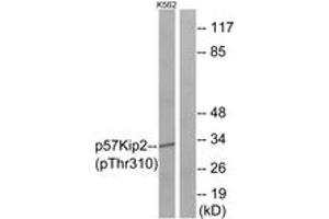 Western blot analysis of extracts from K562 cells treated with insulin 0. (CDKN1C anticorps  (pThr310))
