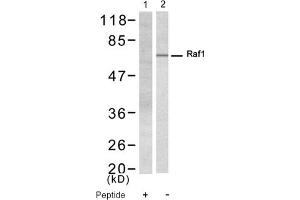 Image no. 1 for anti-V-Raf-1 Murine Leukemia Viral Oncogene Homolog 1 (RAF1) (Ser338) antibody (ABIN319325) (RAF1 anticorps  (Ser338))