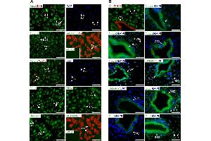 Expression pattern of Notch ligands and receptors in first trimester decidual tissue. (Vimentin anticorps)