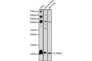 Western blot analysis of extracts of various cell lines, using S100 antibody (ABIN1682611, ABIN3018540, ABIN3018541 and ABIN5664641) at 1:1000 dilution. (S100A6 anticorps  (AA 1-90))
