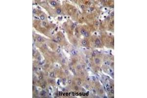 ANKRD18B Antibody (N-term) immunohistochemistry analysis in formalin fixed and paraffin embedded human liver tissue followed by peroxidase conjugation of the secondary antibody and DAB staining. (ANKRD18B anticorps  (N-Term))