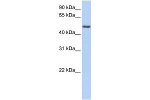 WB Suggested Anti-PHLDA1 Antibody Titration: 0. (PHLDA1 anticorps  (C-Term))