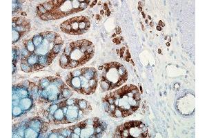 Immunohistochemistry analysis using Mouse Anti-Hsp90 Monoclonal Antibody, Clone H9010 (ABIN361717 and ABIN361718).