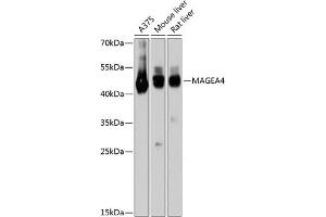 Western blot analysis of extracts of various cell lines, using M antibody (ABIN6128211, ABIN6143437, ABIN6143438 and ABIN6215295) at 1:3000 dilution. (MAGEA4 anticorps  (AA 28-317))