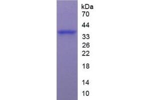 SDS-PAGE of Protein Standard from the Kit (Highly purified E. (ARG Kit ELISA)
