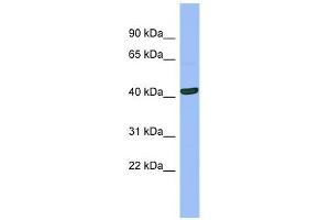 SERPINB13 antibody used at 1 ug/ml to detect target protein. (SERPINB13 anticorps)
