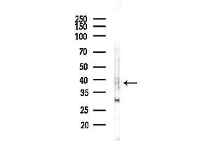anti-Asporin (ASPN) (C-Term) antibody
