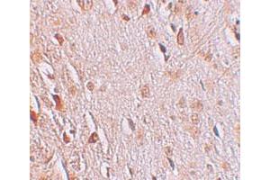 Immunohistochemical staining of human brain cells with WIZ polyclonal antibody  at 2.