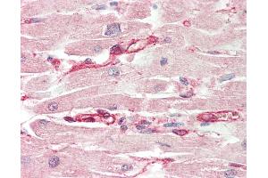 Human, Heart: Formalin-Fixed Paraffin-Embedded (FFPE).