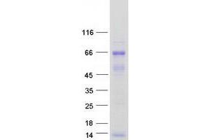 Validation with Western Blot