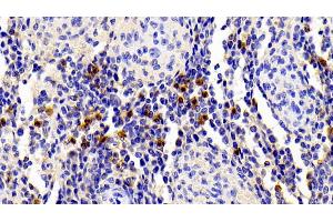 Detection of S100A12 in Porcine Spleen Tissue using Polyclonal Antibody to S100 Calcium Binding Protein A12 (S100A12) (S100A12 anticorps  (AA 2-92))