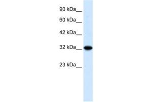 Western Blotting (WB) image for anti-Zinc Finger and BTB Domain Containing 32 (ZBTB32) antibody (ABIN2460305) (ZBTB32 anticorps)
