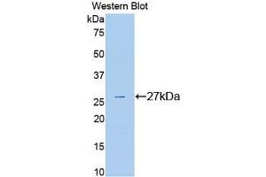 Western blot analysis of the recombinant protein. (PLG anticorps  (AA 582-812))