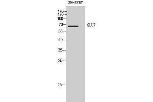 Western Blotting (WB) image for anti-SLU7 Splicing Factor Homolog (SLU7) (Internal Region) antibody (ABIN3186980) (SLU7 anticorps  (Internal Region))