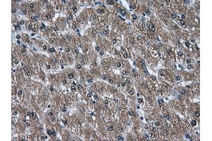 Immunohistochemical staining of paraffin-embedded liver tissue using anti-AKR1A1mouse monoclonal antibody. (AKR1A1 anticorps)