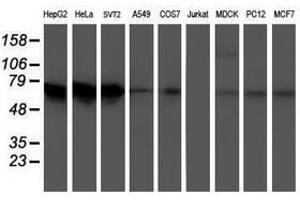Image no. 2 for anti-5-Aminoimidazole-4-Carboxamide Ribonucleotide Formyltransferase/IMP Cyclohydrolase (ATIC) antibody (ABIN1496503) (ATIC anticorps)