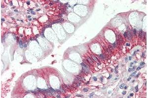 Human Small Intestine (formalin-fixed, paraffin-embedded) stained with x antibody ABIN337227 at 2. (GTPase NRas anticorps  (AA 167-179))