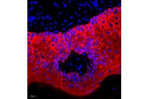Immunofluorescence of paraffin embedded rat oral mucosa using CK13 (ABIN7074412) at dilution of 1:1500 (400x lens)