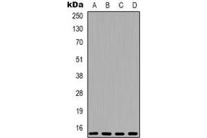 Western blot analysis of 4EBP1 expression in MCF7 (A), HEK293T (B), mouse brain (C), rat brain (D) whole cell lysates. (eIF4EBP1 anticorps  (N-Term))