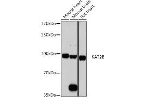 Western blot analysis of extracts of various cell lines, using KB antibody (ABIN1680550, ABIN3015032, ABIN3015033, ABIN5663568 and ABIN6213605) at 1:1000 dilution. (KAT2B anticorps  (AA 583-832))