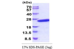 SDS-PAGE (SDS) image for Crystallin, gamma D (CRYGD) (AA 1-174) protein (His tag) (ABIN5854999)