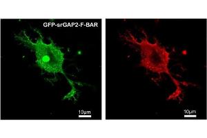 Immunofluorescence (IF) image for anti-SLIT-ROBO rho GTPase Activating Protein 2 (SRGAP2) antibody (ABIN5935194) (SRGAP2 anticorps)