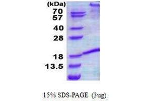 Figure annotation denotes ug of protein loaded and % gel used. (FASL Protéine)